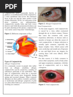 Comprehensive Nursing Eye Assessment | PDF