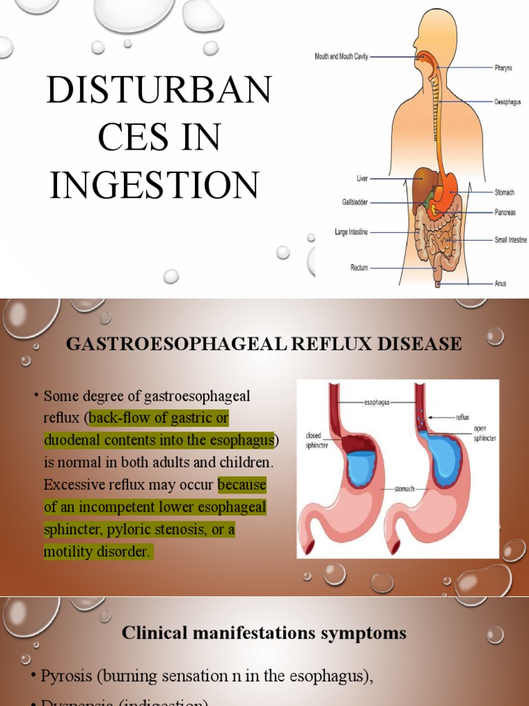Gastroesophageal Disorders Overview | PDF | Esophagus ...
