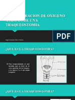 Administracion de Oxigeno Atraves de Una Traqueostomia - Angie Chalco Huanca