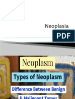 Neoplasia