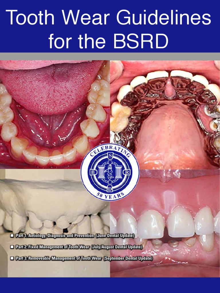 BSRD Tooth Wear Booklet PDF Tooth Enamel Health Sciences