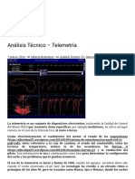 Análisis Técnico - Telemetría - AlbrodpulF1