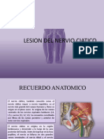 Lesion Del Nervio Ciatico