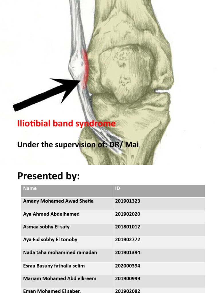 Anatomy, Bony Pelvis And Lower Limb, Iliotibial Band – WKNPQ