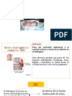 Hernia Diafragmática Congénita: Mg. Miriam Maquera Ramos