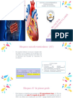 3.3.5 Bloqueo Auriculaventricular