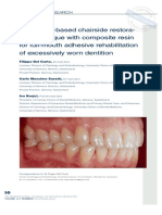 CAD:CAM-based chairside restora- tive technique with composite resin for full-mouth adhesive rehabilitation of excessively worn dentition