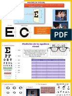 Agudeza visual