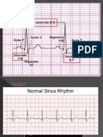 Electrocardiograma Parte 2