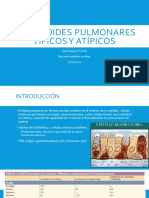 Carcinoides Pulmonares