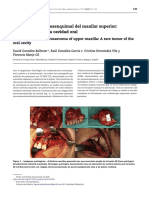 Condrosarcoma Mesenquimal