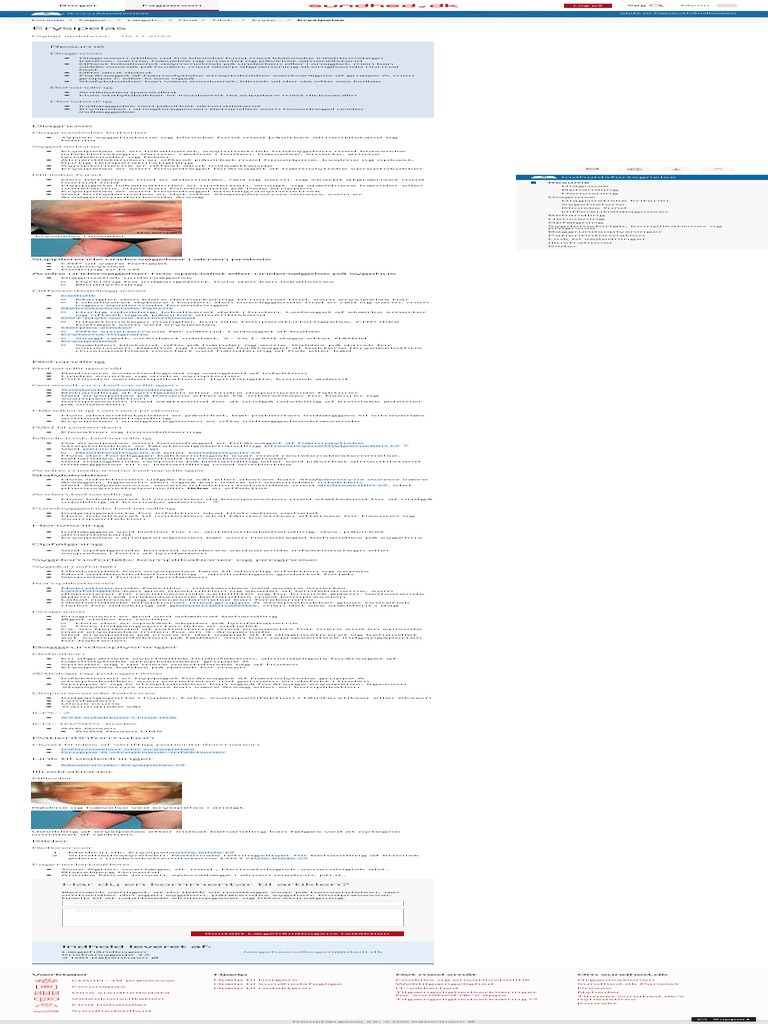 erysipelas-l-geh-ndbogen-p-sundhed-dk-pdf