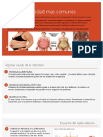 Maderoterapia Tipos de Obesidad