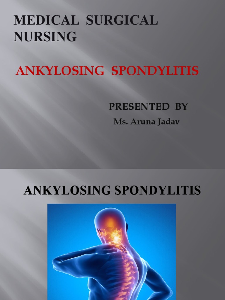 Ankylosing Spondylitis | Download Free PDF | Vertebral Column ...