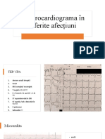 ECG4