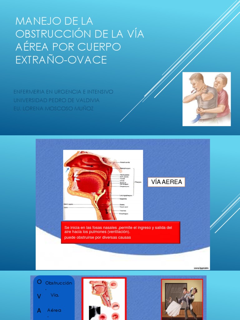OVACE | PDF