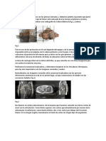 PTC Cadera, Pierna, Tobillo, Pie, VB, Po, PF, Tendon de Aquiles, Rodilla