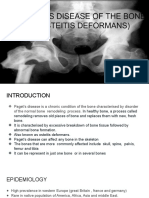 Paget's Disease of The Bone