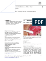 Ulcerative Lesions of The Oral Mucosa: Yu Zhou, Xiaoying Li, Xin Jin, and Qianming Chen