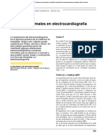 Variantes Normales en Electrocardiografía