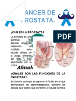 Cancer de Prostata Charla.