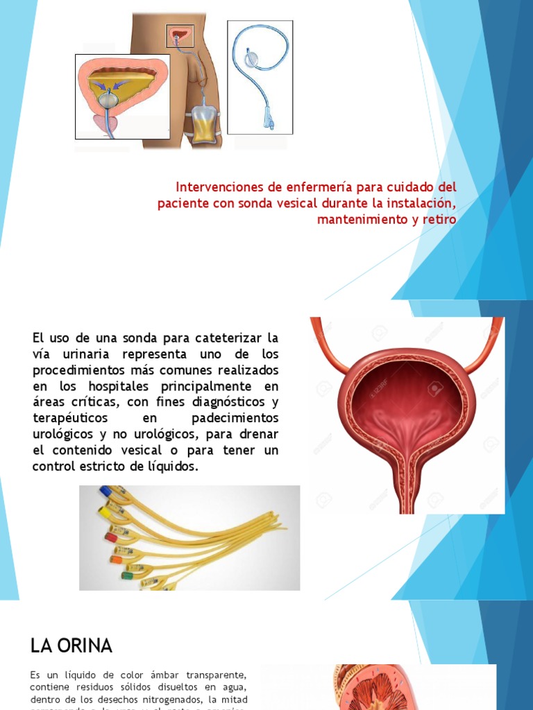 Cuidados de Enfermería en Sonda Vesical | PDF | Anatomia animal ...