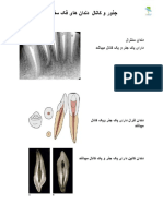 جذور و کانال دندان های سفلی