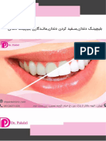 بلیچینگ دندانسفید کردن دندانماندگاری بلیچینگ دندان