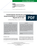 Condromatosis Sinovial (Tendra Relacion Con Factor Psicologico Duda)