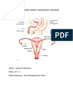 Penyakit Pada Sistem Reproduksi Manusia: Nama: Danisa Putriawan Kelas: IX - 5 Mata Pelajaran: Ilmu Pengetahuan Alam