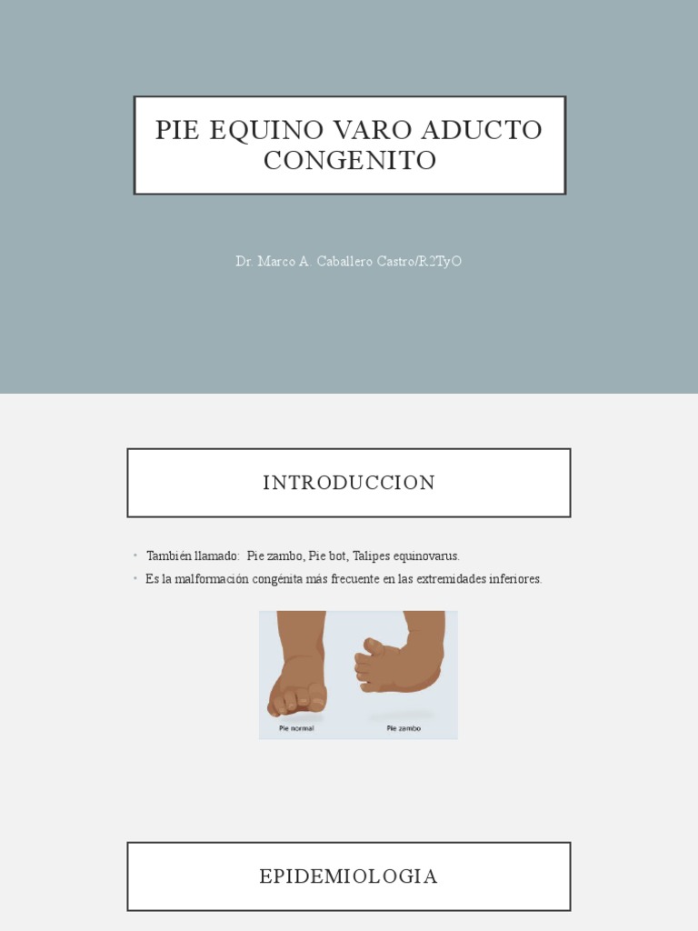 Pie Equinovaro PDF Pie Sistema musculoesquelético