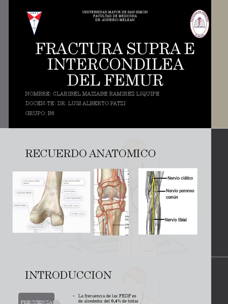 Fractura Supra e Intercondílea del Fémur | PDF