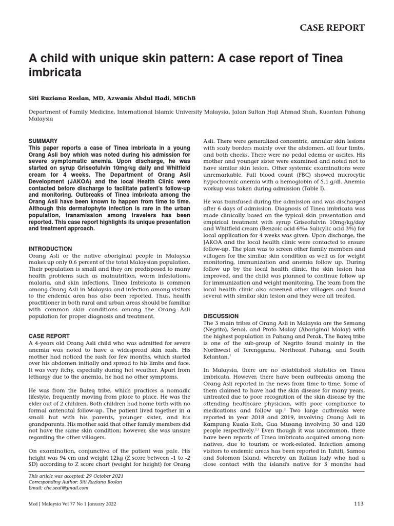 Tinea Imbricata PDF Clinical Medicine Medical Specialties