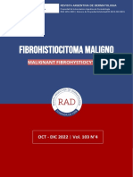 Fibrohistiocitoma Maligno: Malignant Fibrohystiocytoma