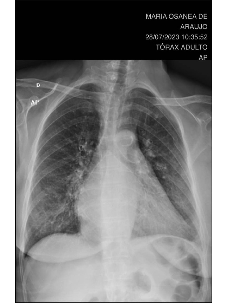 Imagens rx pa e lateral pdf