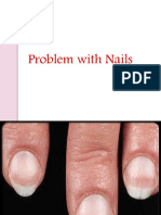 Problem in Nails (Roziel)