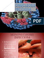 Mononucleosis 
