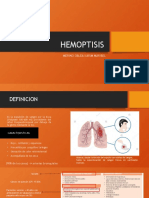 Hemoptisis Merino Oblea Karim