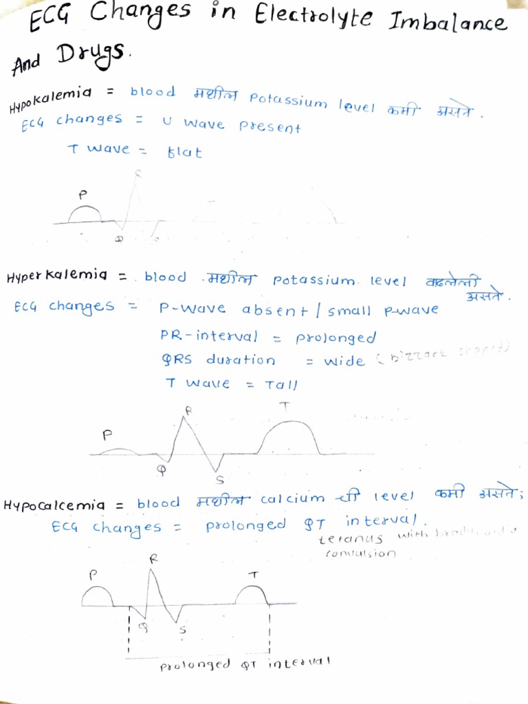 Electrolyte Imbalance Pdf Electrocardiography Cardiac