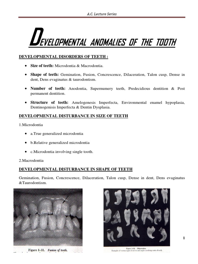 Developmental Anomalies of Teeth | PDF | Human Tooth | Tooth Enamel