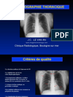 La Radiographie Thoraciquefinal