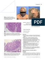 Int J Dermatology - 2022 - Iwasawa - Diagnostic Difficulties in Secondary Syphilis A Case Report