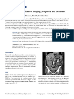 Tumor Thrombus: Incidence, Imaging, Prognosis and Treatment