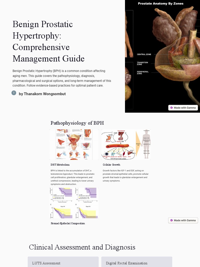 Benign Prostatic Hypertrophy Comprehensive Management Guide 2  PDF  Prostate  Prostate Cancer