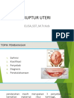 Ruptur Uteri (Ajeng MK Gadar)