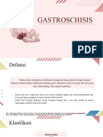 Gastroschisis