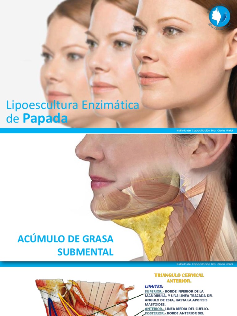 se puede inyectar l carnitina en la papada Lipoescultura Enzimática de Papada | PDF
