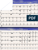 Gambar ECG1