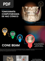 Tomografía Cone Beam en Odontología | PDF | Ct Scan | Física Médica