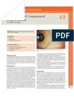 Pterygium and Conjunctival Degenerations